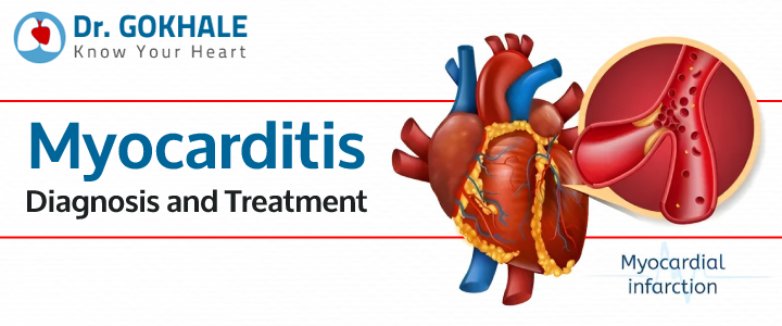 Myocarditis Diagnosis and Treatment | Dr Gokhale