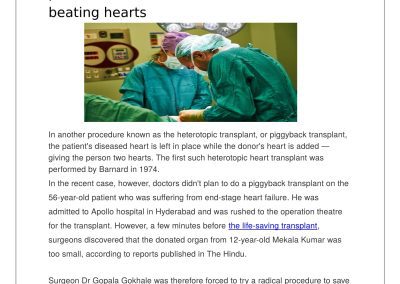 International Coverage on Piggyback Heart Transplant Surgery by Dr Gokhale and Team