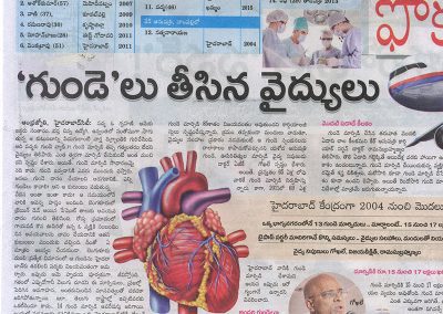 Successful Heart Transplantation in Three Hours And Forty Minutes, Just Before the Dead Line