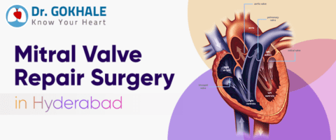 Mitral Valve Repair Surgery in Hyderabad | Dr. Gokhale - Surgeon