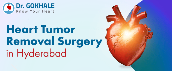 Heart Tumor Removal Surgery in Hyderabad