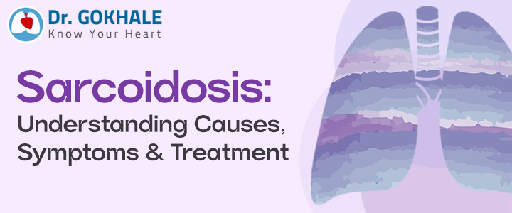 Sarcoidosis: Understanding Causes, Symptoms and Treatment