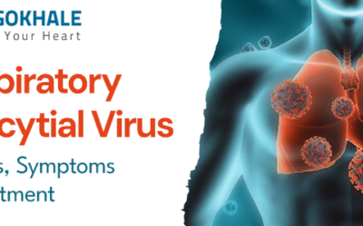 Respiratory Syncytial Virus: Causes, Symptoms, and Treatment