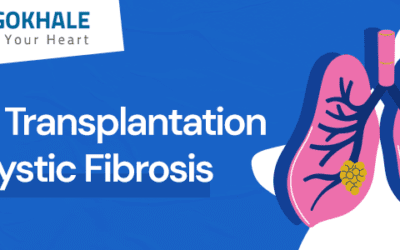 Cystic Fibrosis: Complications and Lung Transplant Treatment