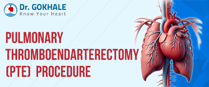 Pulmonary Thromboendarterectomy (PTE) Procedure | Dr Gokhale