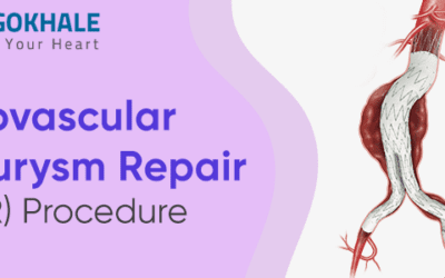 Endovascular Aneurysm Repair (EVAR) Procedure