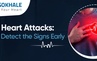 Silent Heart Attacks: How to Detect the Signs Early